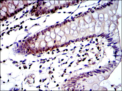 PSMB8 / LMP7 Antibody - IHC of paraffin-embedded colon tissues using PSMB8 mouse monoclonal antibody with DAB staining.