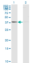 PSMB8 / LMP7 Antibody - Western blot of PSMB8 expression in transfected 293T cell line by PSMB8 monoclonal antibody (M01), clone 1B3.