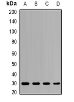 PSMB8 / LMP7 Antibody - Western blot analysis of PSMB8 expression in HepG2 (A); HL60 (B); mouse liver (C); mouse spleen (D) whole cell lysates.