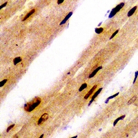 PSMB8 / LMP7 Antibody - Immunohistochemical analysis of PSMB8 staining in rat heart formalin fixed paraffin embedded tissue section. The section was pre-treated using heat mediated antigen retrieval with sodium citrate buffer (pH 6.0). The section was then incubated with the antibody at room temperature and detected using an HRP conjugated compact polymer system. DAB was used as the chromogen. The section was then counterstained with hematoxylin and mounted with DPX.