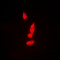 PSMB8 / LMP7 Antibody - Immunofluorescent analysis of PSMB8 staining in A549 cells. Formalin-fixed cells were permeabilized with 0.1% Triton X-100 in TBS for 5-10 minutes and blocked with 3% BSA-PBS for 30 minutes at room temperature. Cells were probed with the primary antibody in 3% BSA-PBS and incubated overnight at 4 deg C in a humidified chamber. Cells were washed with PBST and incubated with a DyLight 594-conjugated secondary antibody (red) in PBS at room temperature in the dark.