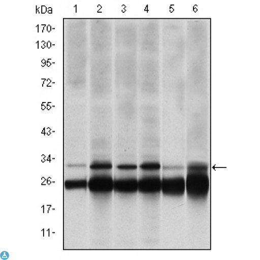 PSMB8 / LMP7 Antibody - Western Blot (WB) analysis using LMP7A Monoclonal Antibody against HeLa (1), MCF-7 (2), A431 (3), RAJI (4), MOTL4 (5) and PC-12 (6) cell lysate.