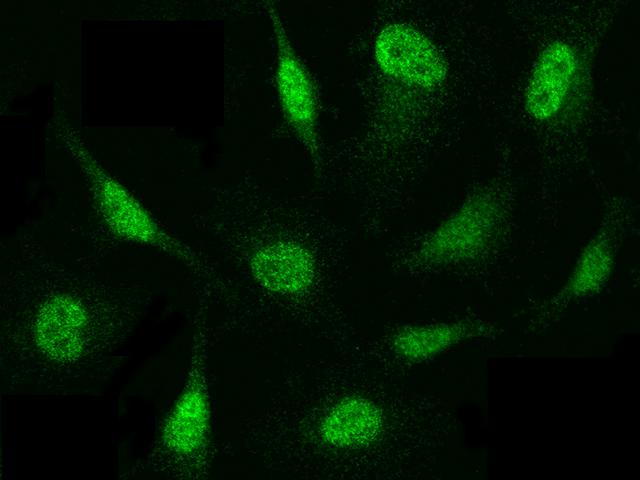PSMB8 / LMP7 Antibody - Immunofluorescence staining of PSMB8 in HeLa cells. Cells were fixed with 4% PFA, permeabilzed with 0.3% Triton X-100 in PBS, blocked with 10% serum, and incubated with rabbit anti-Human PSMB8 polyclonal antibody (dilution ratio 1:1000) at 4°C overnight. Then cells were stained with the Alexa Fluor 488-conjugated Goat Anti-rabbit IgG secondary antibody (green). Positive staining was localized to cytoplasm and nucleus.