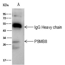 PSMB8 / LMP7 Antibody - PSMB8 was immunoprecipitated using: Lane A: 0.5 mg A431 Whole Cell Lysate. 2 uL anti-PSMB8 rabbit polyclonal antibody and 60 ug of Immunomagnetic beads Protein A/G. Primary antibody: Anti-PSMB8 rabbit polyclonal antibody, at 1:100 dilution. Secondary antibody: Goat Anti-Rabbit IgG (H+L)/HRP at 1/10000 dilution. Developed using the ECL technique. Performed under reducing conditions. Predicted band size: 30 kDa. Observed band size: 30 kDa.