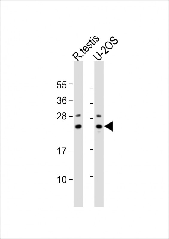 PSMB9 Antibody - All lanes: Anti-PSMB9 Antibody at 1:2000 dilution. Lane 1: rat testis lysate. Lane 2: U-2OS whole cell lysate Lysates/proteins at 20 ug per lane. Secondary Goat Anti-Rabbit IgG, (H+L), Peroxidase conjugated at 1:10000 dilution. Predicted band size: 23 kDa. Blocking/Dilution buffer: 5% NFDM/TBST.