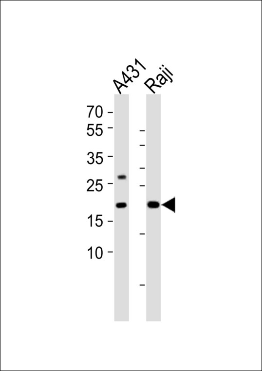 PSMB9 Antibody - All lanes : Anti-PSMB9 Antibody at 1:4000 dilution Lane 1: A431 whole cell lysates Lane 2: Raji whole cell lysates Lysates/proteins at 20 ug per lane. Secondary Goat Anti-Rabbit IgG, (H+L), Peroxidase conjugated at 1/10000 dilution Predicted band size : 23 kDa Blocking/Dilution buffer: 5% NFDM/TBST.
