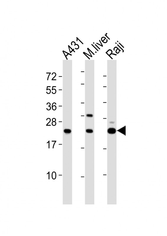 PSMB9 Antibody - All lanes : Anti-PSMB9 Antibody at 1:2000 dilution Lane 1: A431 whole cell lysates Lane 2: mouse liver lysates Lane 3: Raji whole cell lysates Lysates/proteins at 20 ug per lane. Secondary Goat Anti-Rabbit IgG, (H+L), Peroxidase conjugated at 1/10000 dilution Predicted band size : 23 kDa Blocking/Dilution buffer: 5% NFDM/TBST.