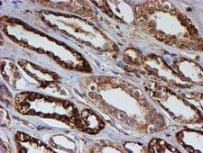 PSMB9 Antibody - IHC of paraffin-embedded Human Kidney tissue using anti-PSMB9 mouse monoclonal antibody. (Heat-induced epitope retrieval by 10mM citric buffer, pH6.0, 100C for 10min).