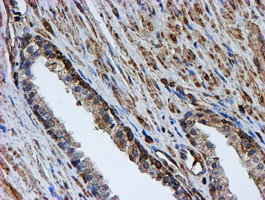 PSMB9 Antibody - IHC of paraffin-embedded Human prostate tissue using anti-PSMB9 mouse monoclonal antibody. (Heat-induced epitope retrieval by 10mM citric buffer, pH6.0, 100C for 10min).