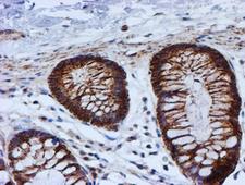 PSMB9 Antibody - IHC of paraffin-embedded Human colon tissue using anti-PSMB9 mouse monoclonal antibody.