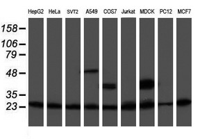 PSMB9 Antibody - Western blot of extracts (35ug) from 9 different cell lines by using anti-PSMB9 monoclonal antibody.