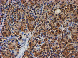 PSMB9 Antibody - IHC of paraffin-embedded Human pancreas tissue using anti-PSMB9 mouse monoclonal antibody. (Heat-induced epitope retrieval by 10mM citric buffer, pH6.0, 100C for 10min).