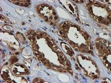 PSMB9 Antibody - IHC of paraffin-embedded Human Kidney tissue using anti-PSMB9 mouse monoclonal antibody. (Heat-induced epitope retrieval by 10mM citric buffer, pH6.0, 100C for 10min).