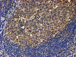 PSMB9 Antibody - IHC of paraffin-embedded Human tonsil using anti-PSMB9 mouse monoclonal antibody. (Heat-induced epitope retrieval by 10mM citric buffer, pH6.0, 100C for 10min).