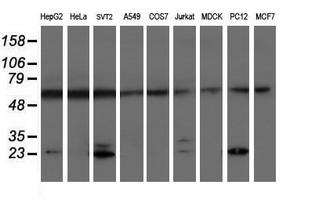 PSMB9 Antibody - Western blot of extracts (35 ug) from 9 different cell lines by using anti-PSMB9 monoclonal antibody (HepG2: human; HeLa: human; SVT2: mouse; A549: human; COS7: monkey; Jurkat: human; MDCK: canine; PC12: rat; MCF7: human).