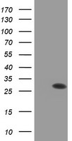 PSMB9 Antibody - HEK293T cells were transfected with the pCMV6-ENTRY control (Left lane) or pCMV6-ENTRY PSMB9 (Right lane) cDNA for 48 hrs and lysed. Equivalent amounts of cell lysates (5 ug per lane) were separated by SDS-PAGE and immunoblotted with anti-PSMB9.