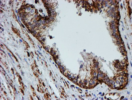 PSMB9 Antibody - IHC of paraffin-embedded Human prostate tissue using anti-PSMB9 mouse monoclonal antibody.