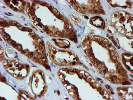 PSMB9 Antibody - IHC of paraffin-embedded Human Kidney tissue using anti-PSMB9 mouse monoclonal antibody.