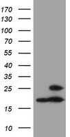 PSMB9 Antibody - HEK293T cells were transfected with the pCMV6-ENTRY control (Left lane) or pCMV6-ENTRY PSMB9 (Right lane) cDNA for 48 hrs and lysed. Equivalent amounts of cell lysates (5 ug per lane) were separated by SDS-PAGE and immunoblotted with anti-PSMB9.