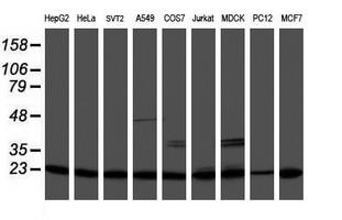 PSMB9 Antibody - Western blot of extracts (35 ug) from 9 different cell lines by using anti-PSMB9 monoclonal antibody.