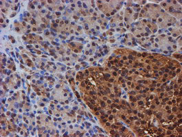 PSMB9 Antibody - IHC of paraffin-embedded Human pancreas tissue using anti-PSMB9 mouse monoclonal antibody.
