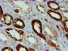 PSMB9 Antibody - IHC of paraffin-embedded Human Kidney tissue using anti-PSMB9 mouse monoclonal antibody.