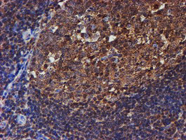 PSMB9 Antibody - IHC of paraffin-embedded Human tonsil using anti-PSMB9 mouse monoclonal antibody.