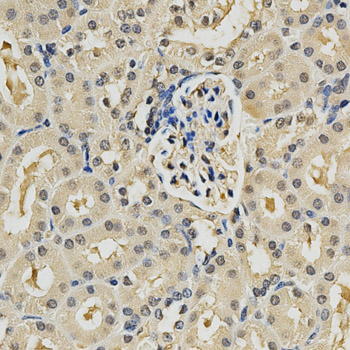 PSMB9 Antibody - Immunohistochemistry of paraffin-embedded mouse kidney tissue.