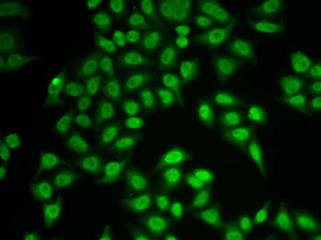 PSMB9 Antibody - Immunofluorescence analysis of MCF-7 cells using PSMB9 antibody.