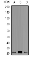 PSMB9 Antibody - Western blot analysis of PSMB9 expression in HepG2 (A); THP1 (B); mouse liver (C) whole cell lysates.