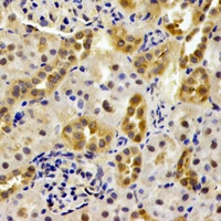 PSMB9 Antibody - Immunohistochemical analysis of PSMB9 staining in mouse kidney formalin fixed paraffin embedded tissue section. The section was pre-treated using heat mediated antigen retrieval with sodium citrate buffer (pH 6.0). The section was then incubated with the antibody at room temperature and detected using an HRP conjugated compact polymer system. DAB was used as the chromogen. The section was then counterstained with hematoxylin and mounted with DPX.