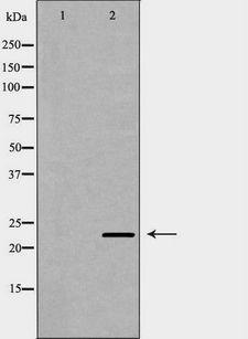 PSMB9 Antibody - Western blot analysis of K562 cell lysates using PSMB9 antibody. The lane on the left is treated with the antigen-specific peptide.