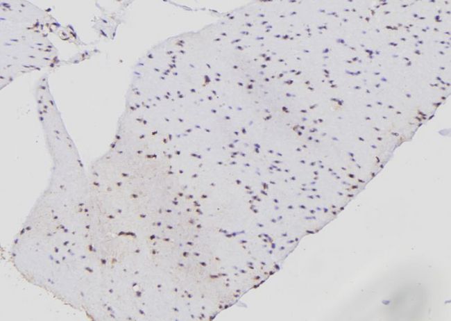 PSMB9 Antibody - 1:100 staining human gastric tissue by IHC-P. The sample was formaldehyde fixed and a heat mediated antigen retrieval step in citrate buffer was performed. The sample was then blocked and incubated with the antibody for 1.5 hours at 22°C. An HRP conjugated goat anti-rabbit antibody was used as the secondary.