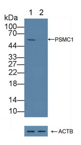 PSMC1 Antibody - Knockout Varification: Lane 1: Wild-type Jurkat cell lysate; Lane 2: PSMC1 knockout Jurkat cell lysate; Predicted MW: 41,49kd Observed MW: 55kd Primary Ab: 5µg/ml Rabbit Anti-Human PSMC1 Antibody Second Ab: 0.2µg/mL HRP-Linked Caprine Anti-Rabbit IgG Polyclonal Antibody