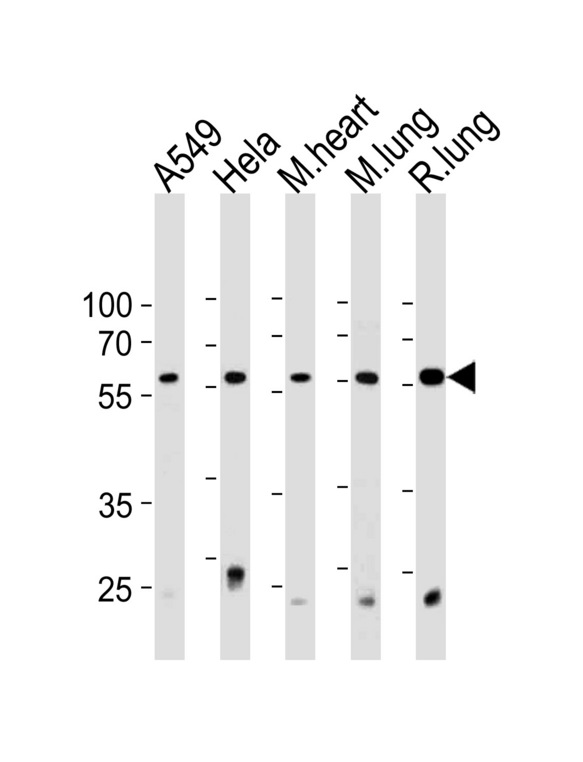 PSMC1 Antibody - PRS4 Antibody western blot of A549,HeLa cell line and mouse heart and lung,rat lung tissue lysates (35 ug/lane). The PRS4 antibody detected the PRS4 protein (arrow).