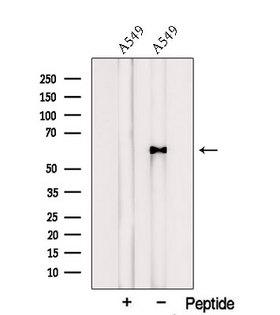 PSMC1 Antibody - Western blot analysis of extracts of A549 cells using PSMC1 antibody. The lane on the left was treated with blocking peptide.