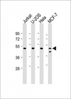 PSMC2 / RPT1 Antibody - All lanes: Anti-PSMC2 at 1:2000 dilution Lane 1: Jurkat whole cell lysate Lane 2: U-2OS whole cell lysate Lane 3: Hela whole cell lysate Lane 4: MCF-7 whole cell lysate Lysates/proteins at 20 µg per lane. Secondary Goat Anti-mouse IgG, (H+L), Peroxidase conjugated at 1/10000 dilution. Predicted band size: 49 kDa Blocking/Dilution buffer: 5% NFDM/TBST.