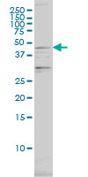 PSMC2 / RPT1 Antibody - PSMC2 monoclonal antibody (M01), clone 4C10-2C8 Western Blot analysis of PSMC2 expression in SW-13.
