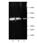 PSMC2 / RPT1 Antibody - Western blot: Composite luminograph of (a) HeLa S3 cytosolic preparation, (b) purified 26S proteasome, and (c) human placental proteasome fraction after SDS PAGE followed by blotting onto PVDF membrane and probing with antibody BML-PW8825. Antibody dilution 1:5000 using ECL procedure (1 min exposure).
