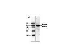 PSMC2 / RPT1 Antibody