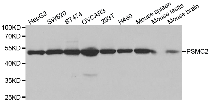 PSMC2 / RPT1 Antibody - Western blot analysis of extracts of various cell lines.