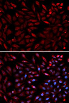 PSMC2 / RPT1 Antibody - Immunofluorescence analysis of U2OS cells.