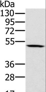 PSMC2 / RPT1 Antibody - Western blot analysis of 231 cell, using PSMC2 Polyclonal Antibody at dilution of 1:500.