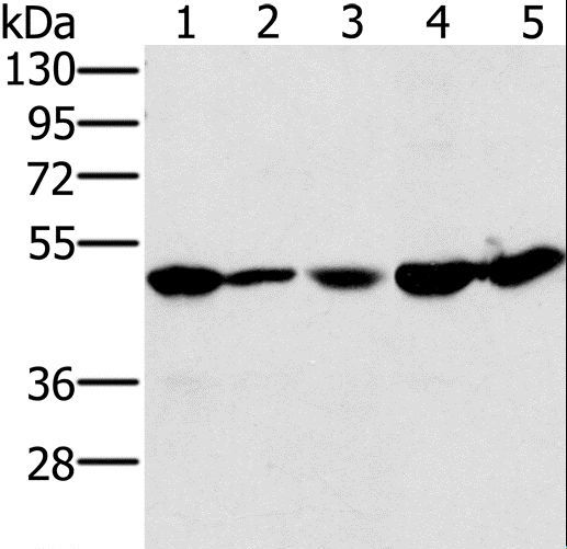 PSMC2 / RPT1 Antibody - Western blot analysis of 231 and Jurkat cell, mouse liver tissue, 293T and HeLa cell, using PSMC2 Polyclonal Antibody at dilution of 1:400.