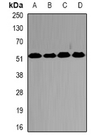 PSMC2 / RPT1 Antibody - Western blot analysis of PSMC2 expression in HepG2 (A); SW620 (B); mouse testis (C); mouse brain (D) whole cell lysates.