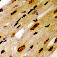 PSMC2 / RPT1 Antibody - Immunohistochemical analysis of PSMC2 staining in mouse heart formalin fixed paraffin embedded tissue section. The section was pre-treated using heat mediated antigen retrieval with sodium citrate buffer (pH 6.0). The section was then incubated with the antibody at room temperature and detected using an HRP conjugated compact polymer system. DAB was used as the chromogen. The section was then counterstained with hematoxylin and mounted with DPX.
