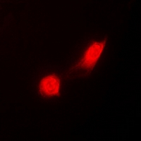 PSMC2 / RPT1 Antibody - Immunofluorescent analysis of PSMC2 staining in MCF7 cells. Formalin-fixed cells were permeabilized with 0.1% Triton X-100 in TBS for 5-10 minutes and blocked with 3% BSA-PBS for 30 minutes at room temperature. Cells were probed with the primary antibody in 3% BSA-PBS and incubated overnight at 4 deg C in a humidified chamber. Cells were washed with PBST and incubated with a DyLight 594-conjugated secondary antibody (red) in PBS at room temperature in the dark.