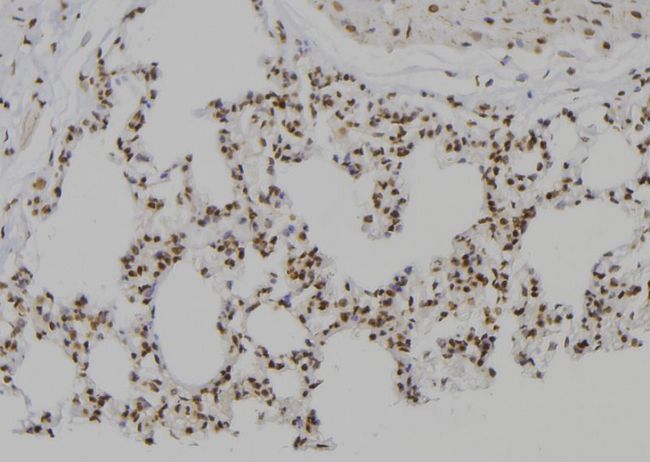 PSMC2 / RPT1 Antibody - 1:100 staining rat lung tissue by IHC-P. The sample was formaldehyde fixed and a heat mediated antigen retrieval step in citrate buffer was performed. The sample was then blocked and incubated with the antibody for 1.5 hours at 22°C. An HRP conjugated goat anti-rabbit antibody was used as the secondary.