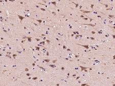 PSMC2 / RPT1 Antibody - Immunochemical staining of human PSMC2 in human brain with rabbit polyclonal antibody at 1:300 dilution, formalin-fixed paraffin embedded sections.