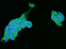 PSMC2 / RPT1 Antibody - Immunofluorescence staining of PSMC2 in HEK293 cells. Cells were fixed with 4% PFA, permeabilzed with 0.1% Triton X-100 in PBS, blocked with 10% serum, and incubated with rabbit anti-Human PSMC2 polyclonal antibody (dilution ratio 1:200) at 4°C overnight. Then cells were stained with the Alexa Fluor 488-conjugated Goat Anti-rabbit IgG secondary antibody (green) and counterstained with DAPI (blue). Positive staining was localized to Cytoplasm.